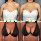 💕LAST DAY SALE ONLY ￡7.99!!💕OUFALI Lift Inserts for Bras – Lightly Padded, Double-Sided Adhesive👙 Reusable, Washable • Natural Lift • Seamless Under Clothing ✨
