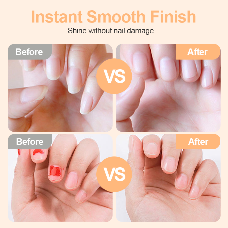 💗LAST DAY SALE 50% OFF💕🌟2-in-1 Safe Electric Nail Clipper