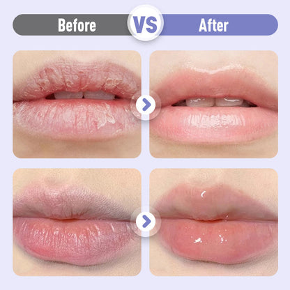 ‌limited-time🛍️Buy 1  get 1 free🎉Plumping & Anti-Wrinkle Hydrating Lip Serum