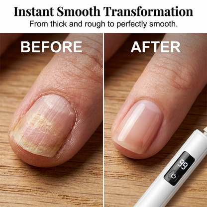 🥳2026 HOT SALE💅✨ 50% OFF! Professional Electric Nail Polisher – Smooths thick nails, 99-speed display. Multiple heads for shaping & buffing. Salon at home! 🌟💎